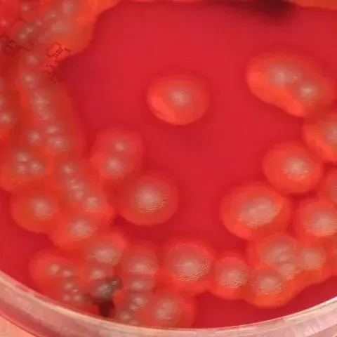 thumbnail for publication: Preventing Foodborne Illness: Bacillus cereus